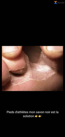 savon-noir-de-royal-cosmetique-traite-les-soucis-de-la-peau-naturel-sans-additif-chimique-et-non-eclaircissant-adapte-a-tous-types-de-peau-big-3