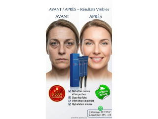 Le Gel liftant contour des yeux !